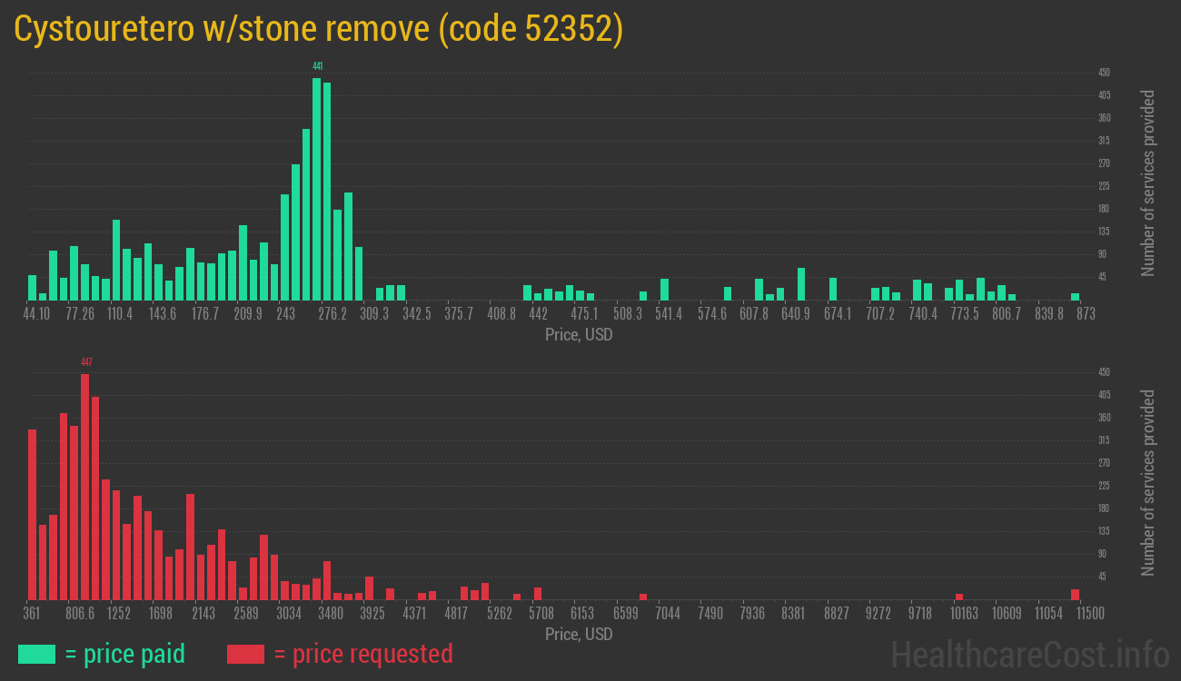 Cystouretero w/stone remove