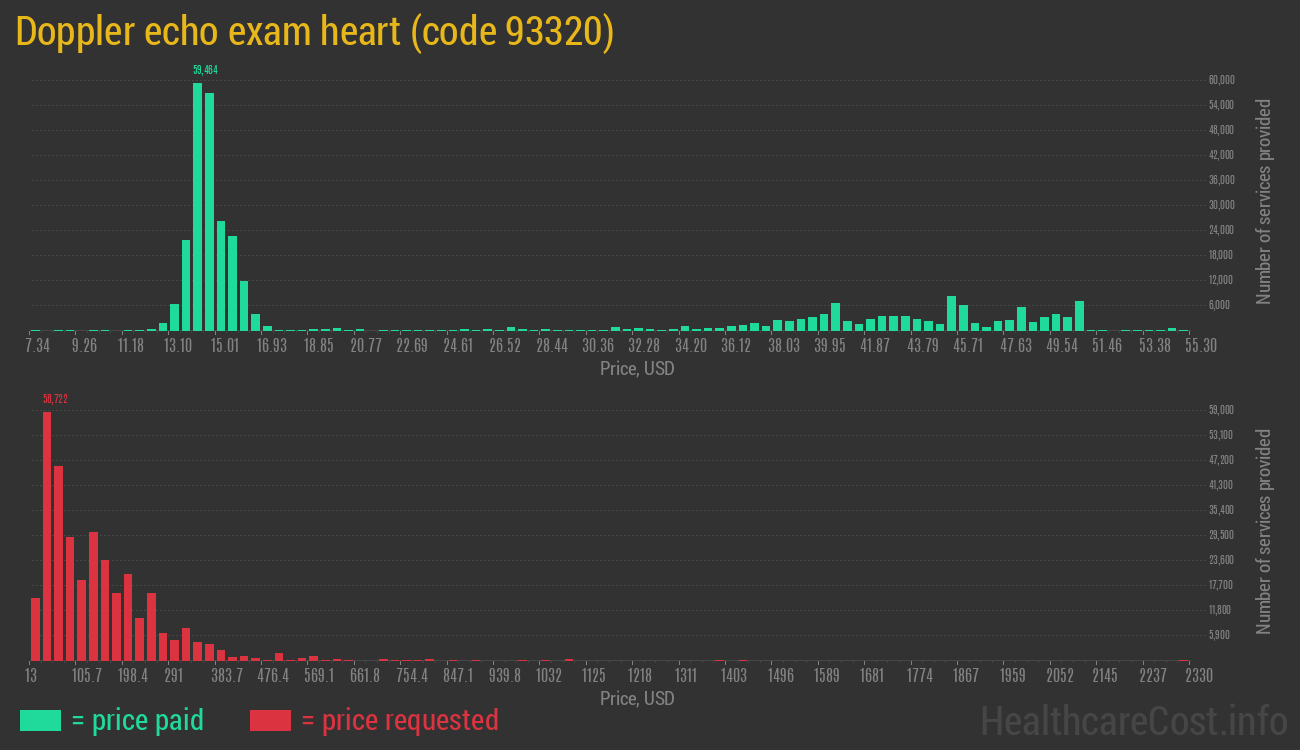 Doppler echo exam heart