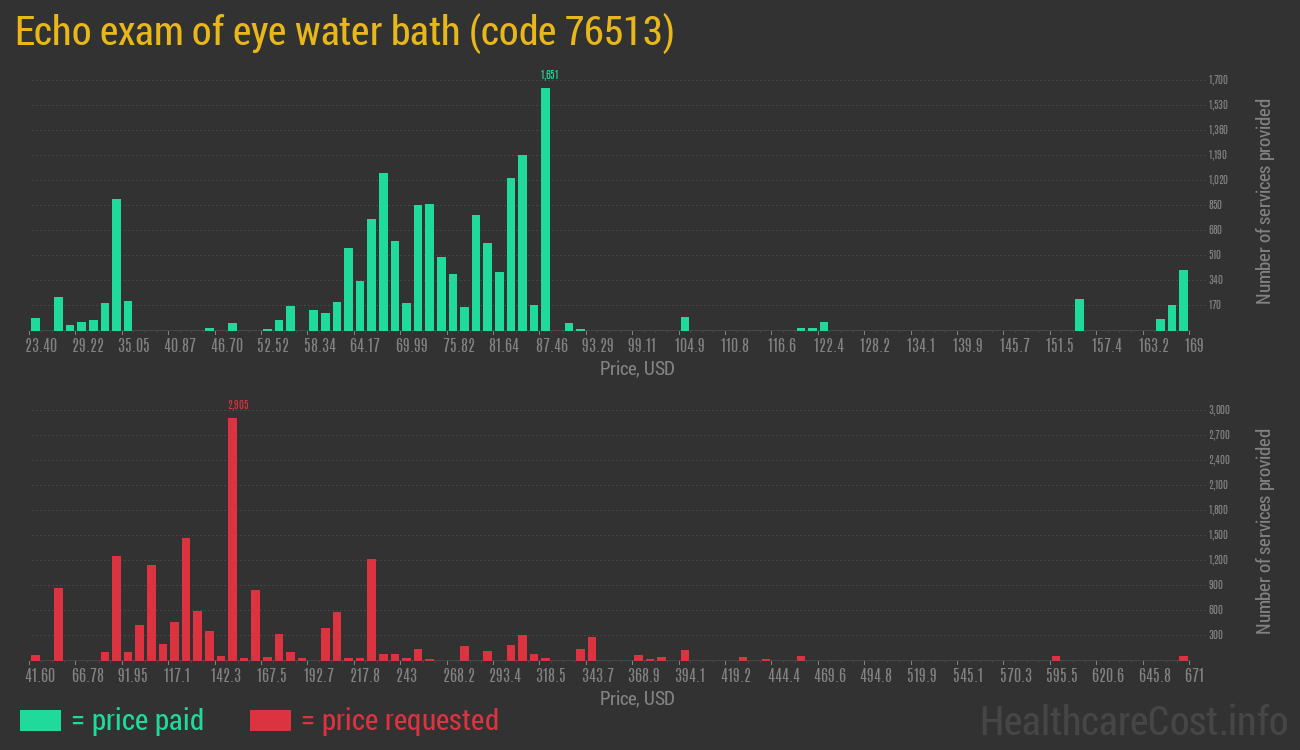 Echo exam of eye water bath