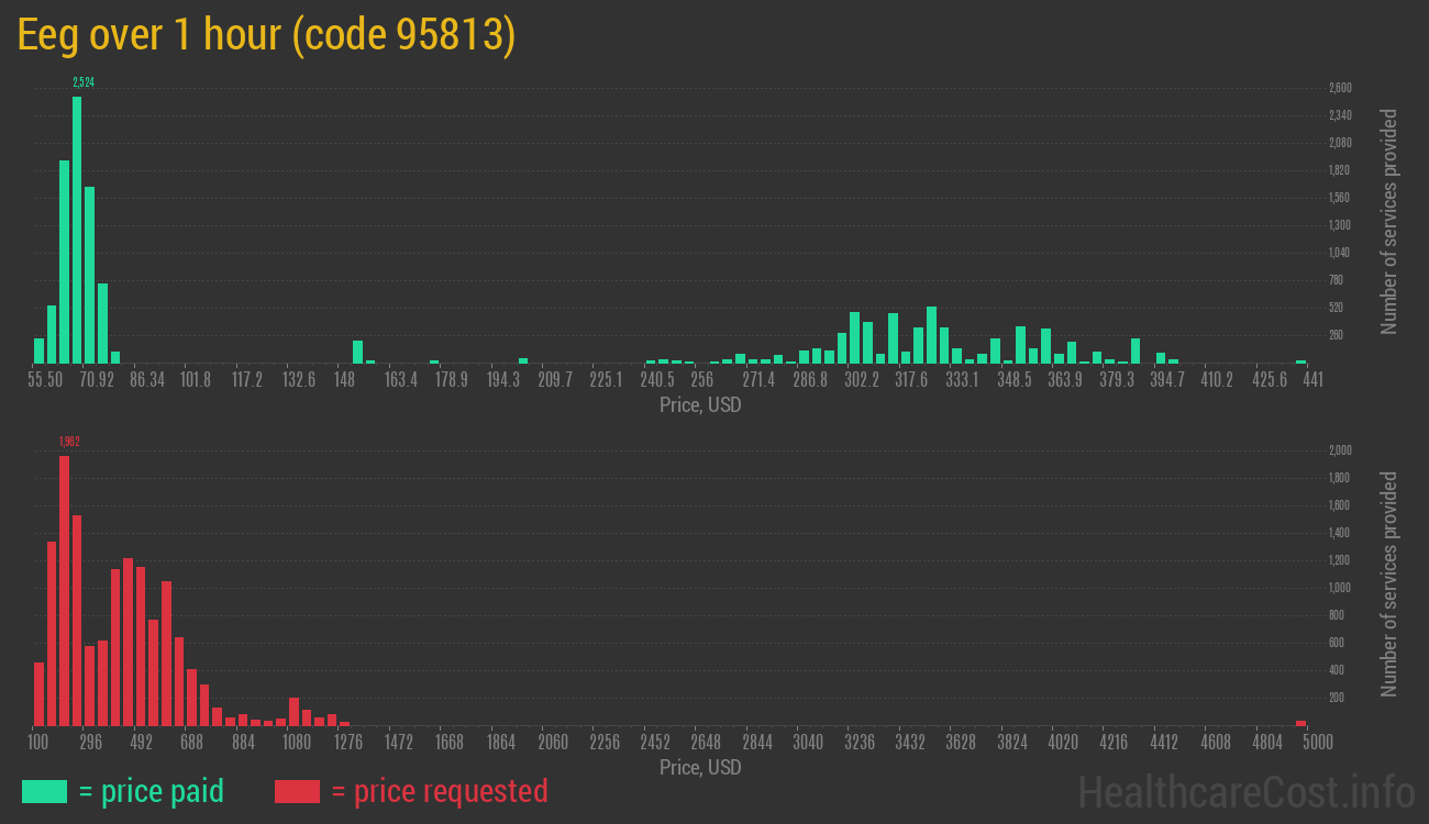 Eeg over 1 hour