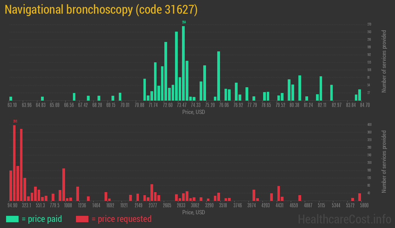 Navigational bronchoscopy