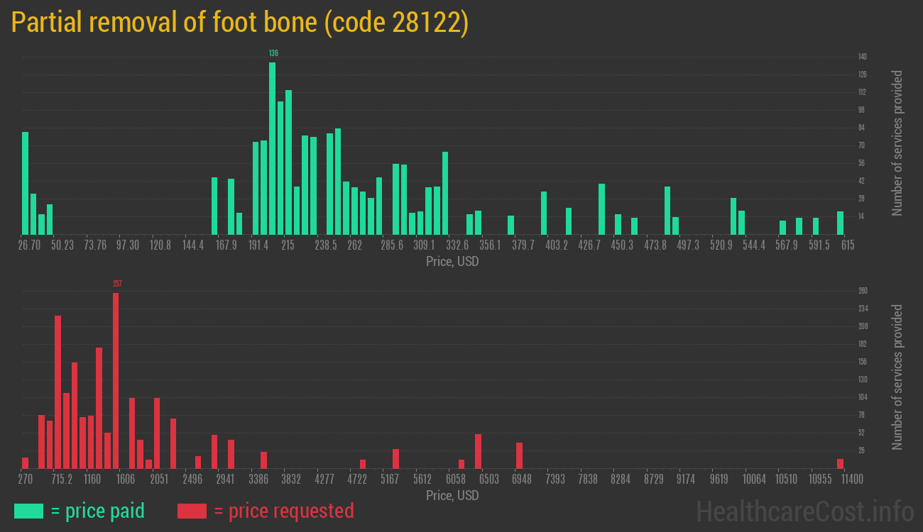 Partial removal of foot bone