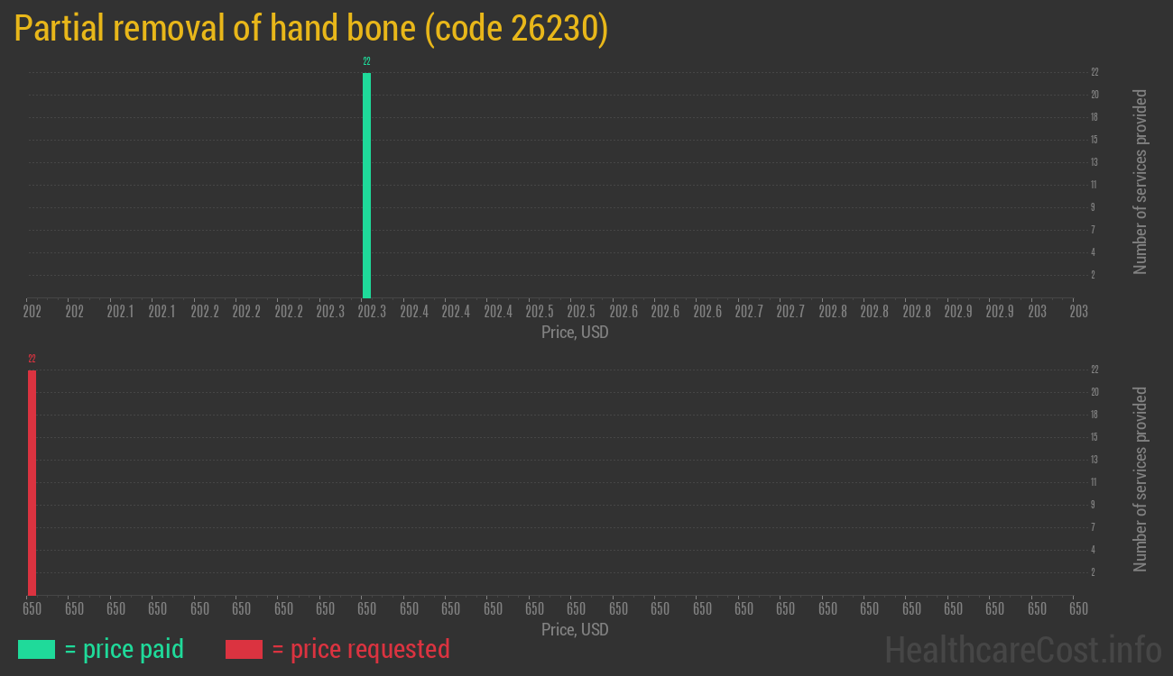 Partial removal of hand bone