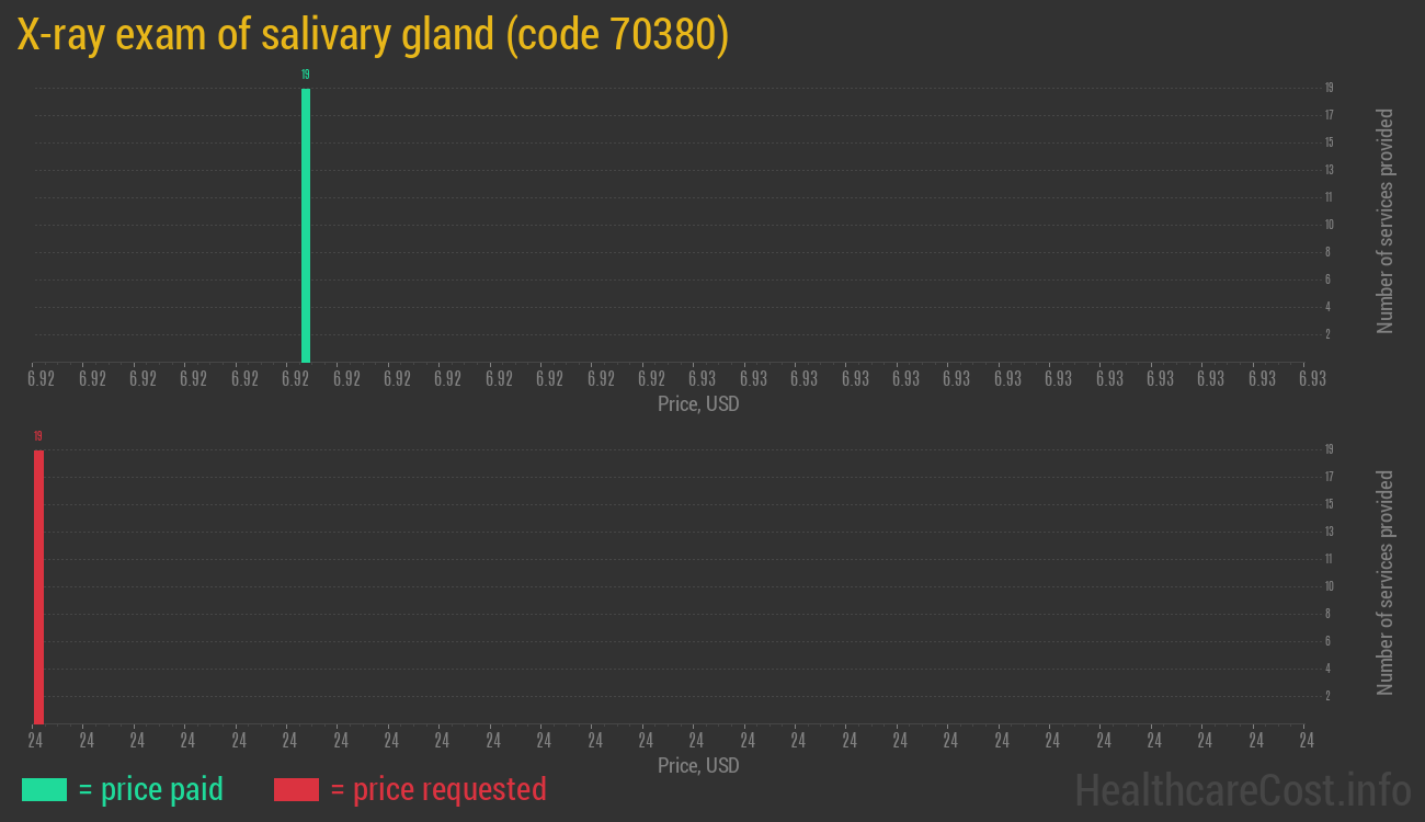 X-ray exam of salivary gland